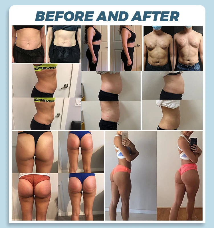 EMS Body Sculpting Machine MYOslim